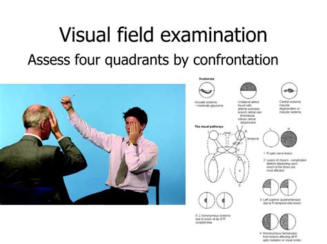 confrontation test used for|Visual Field Testing Technique: Confrontation Testing, .